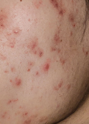 RADIANT SKIN SOLUTION